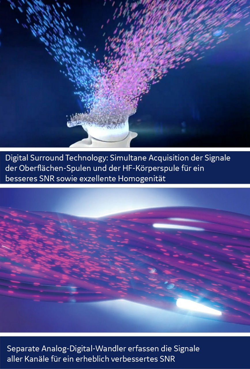 product-product-categories-magnetic-resonance-imaging-signa voyager-dst_ddi.jpg