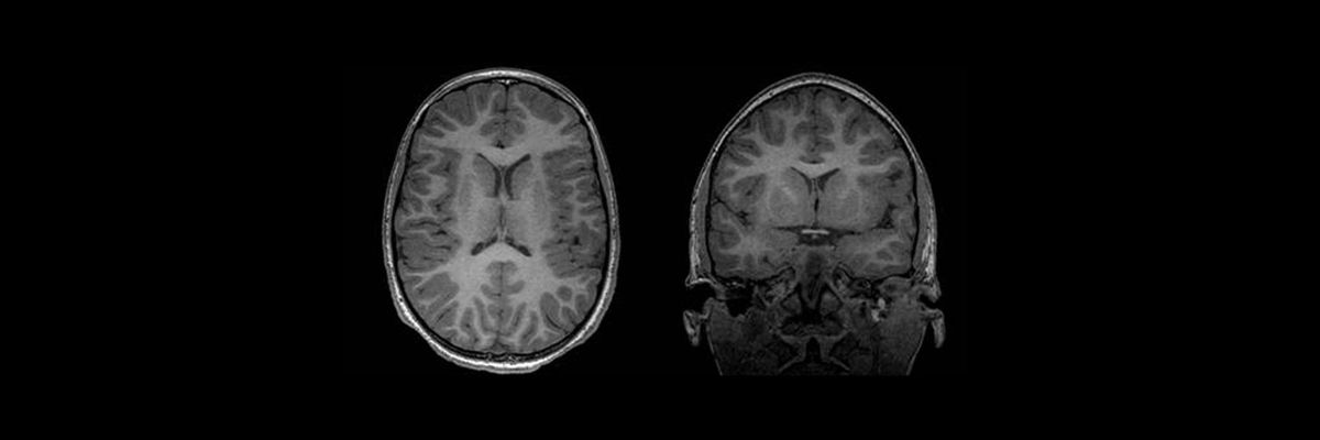 product-product-categories-magnetic-resonance-imaging-cardiac-imaging-bravo-bravo_pediatric_spotlight.jpg