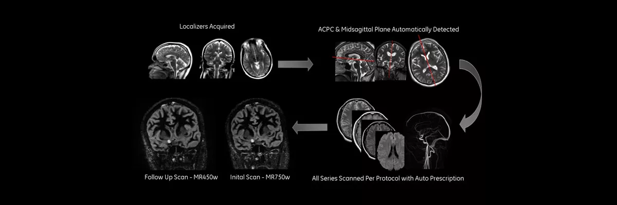 product-product-categories-magnetic-resonance-imaging-neuro-imaging-ready-brain-ready brain_ spotlight new.jpg