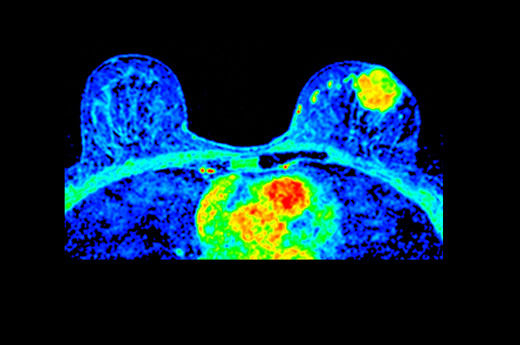 magneticresonanceimagingsigna20artistAxialT1DynamicContrast