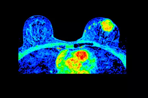 magneticresonanceimagingsigna20artistAxialT1DynamicContrast
