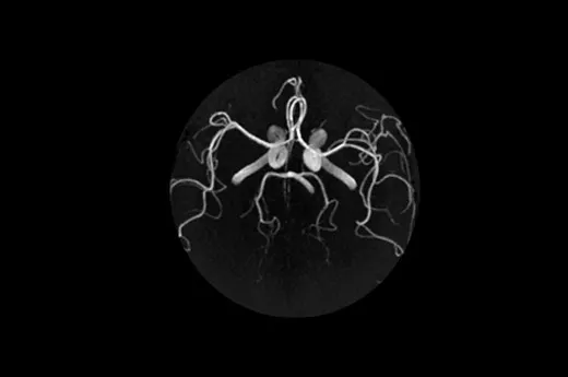magneticresonanceimagingsigna20artistTimeofFlight