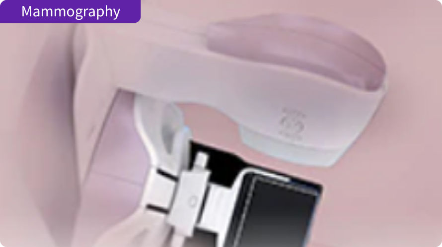 Mammography - Senographe Pristina with new IQ Suite