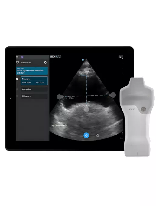 Vscan Handheld Ultrasound | GE HealthCare (Japan)