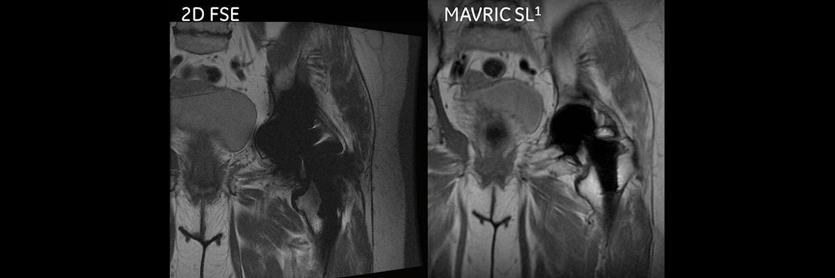 MAVRIC-SL-spotlight-1200