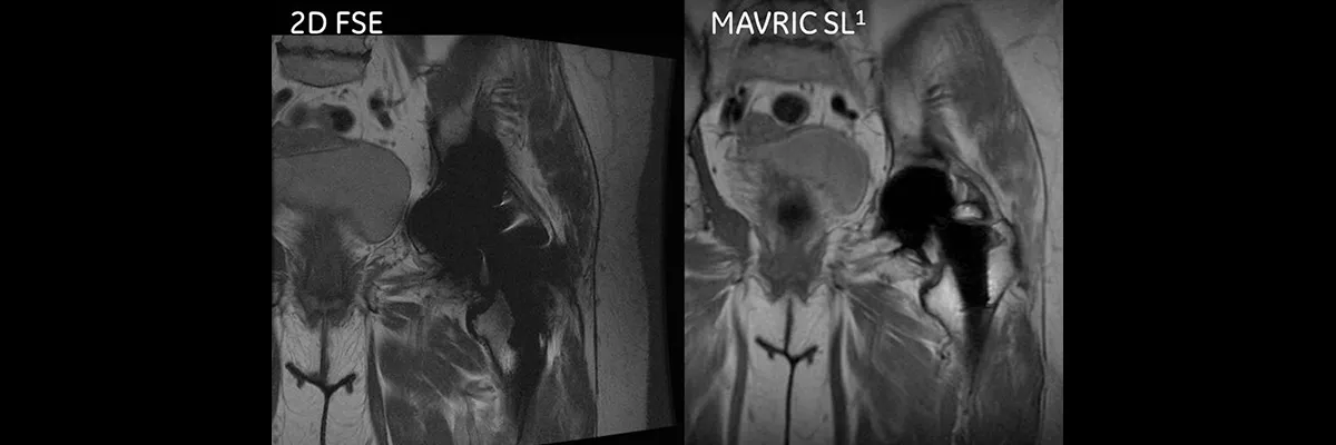MAVRIC-SL-spotlight-1200