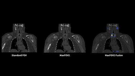MaxFOV2-feature03-desktop