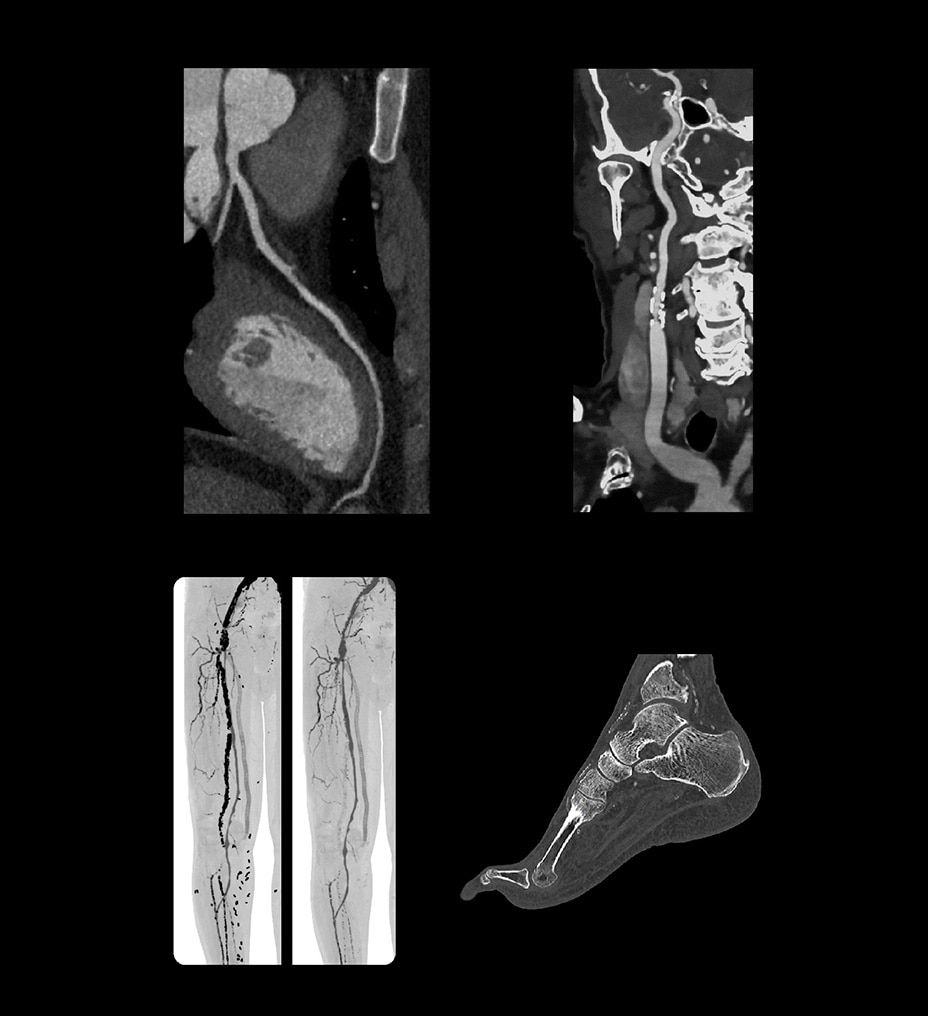 maxima-imaging-chain-st-en
