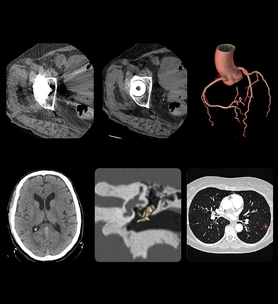 maxima-intelligent-application-st-en