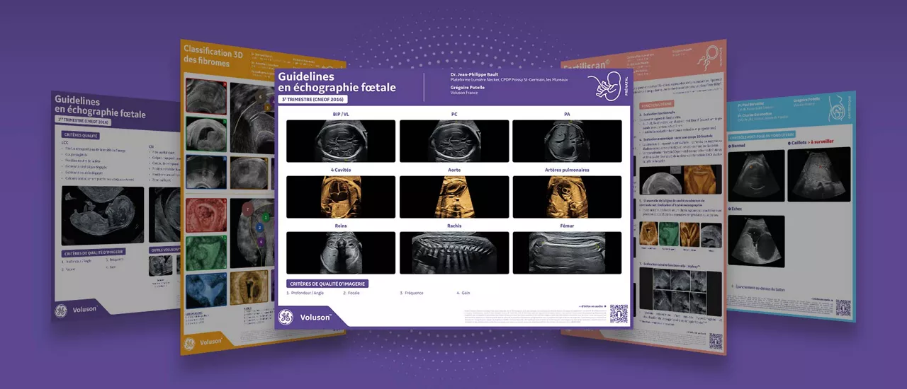 Mcokup-echographie-foetale-3emetrimestre