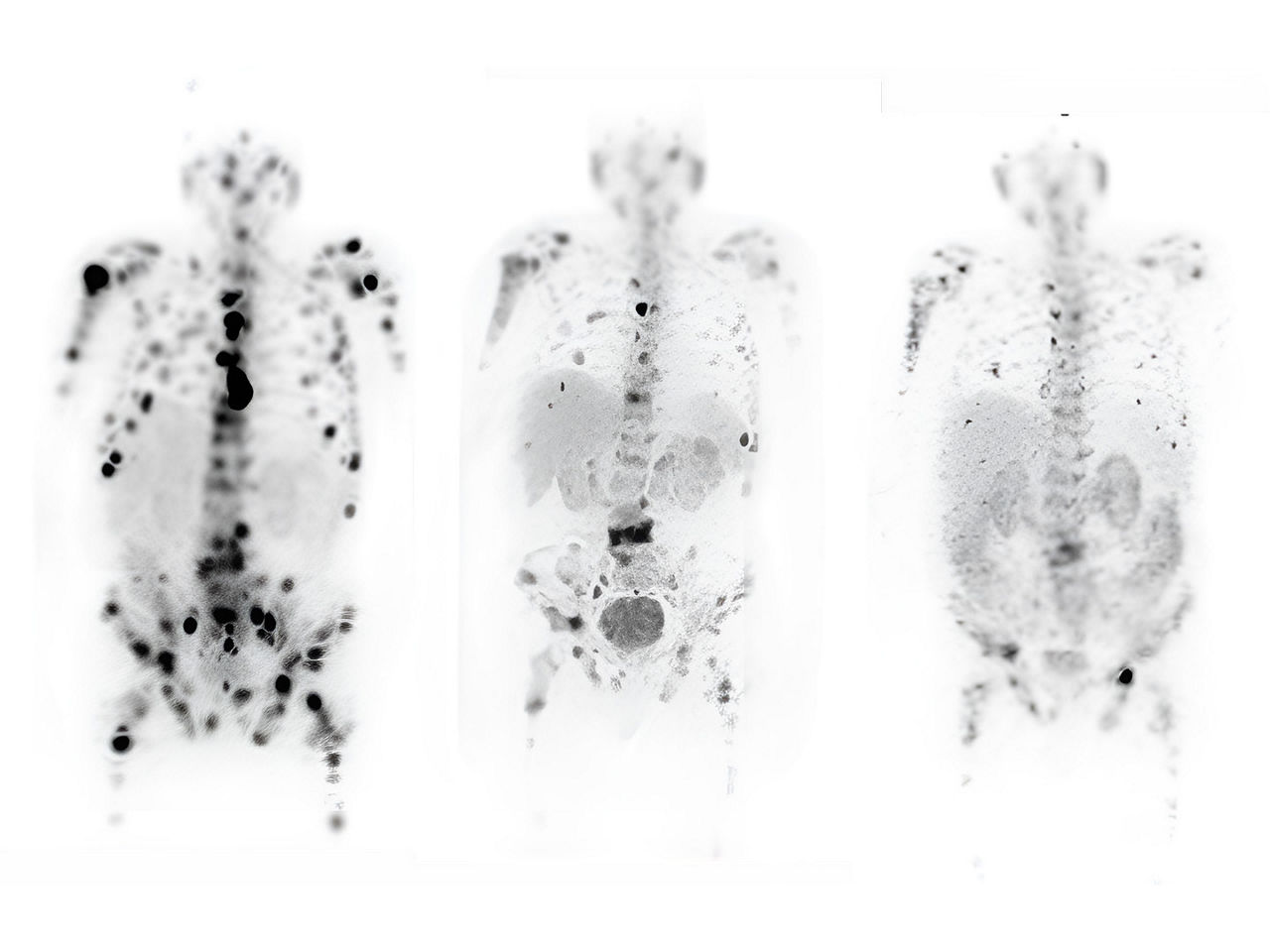 medicine-with-theranostics-ArticleHero-ci-en