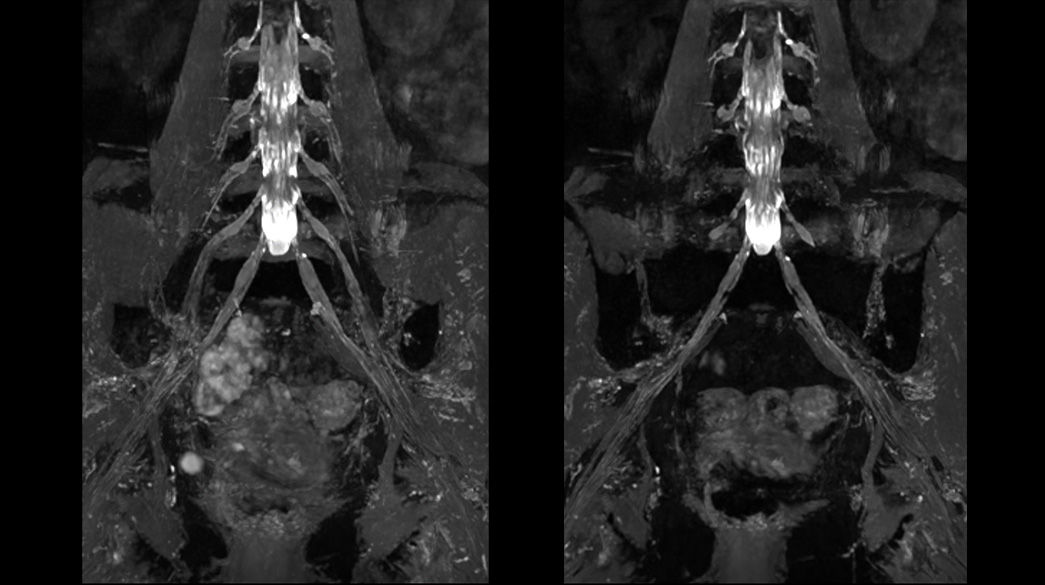 MENSA-Nerve1040-x-585