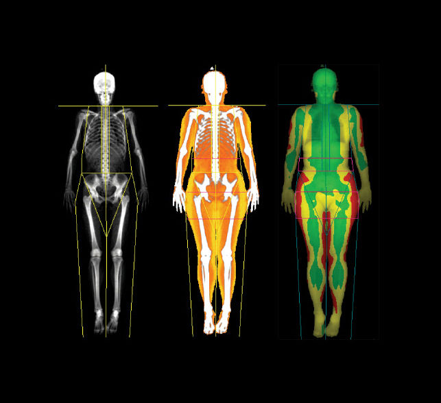 MetabolicInformation