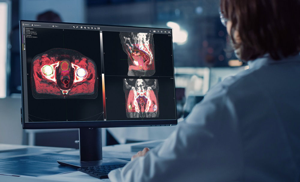 MIM-Software-Eletka-news-LR