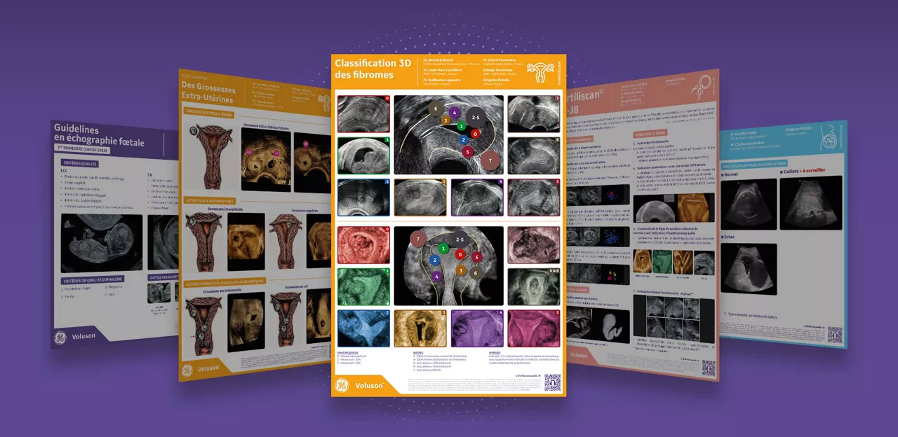 Mockup-gynecologie-classification3d-fibromes-full
