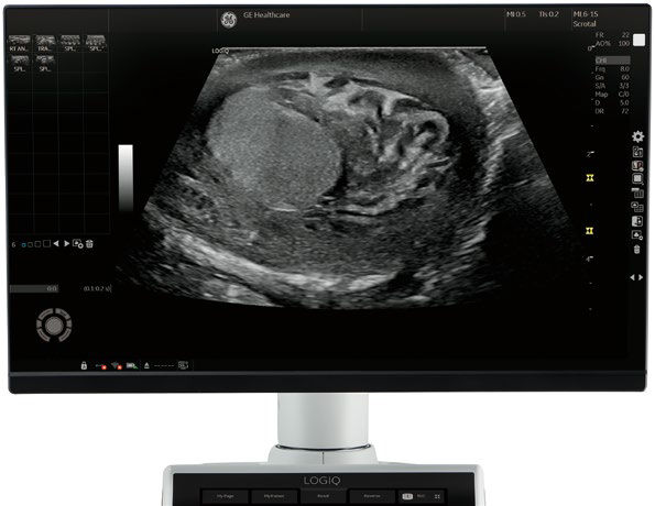 monitor