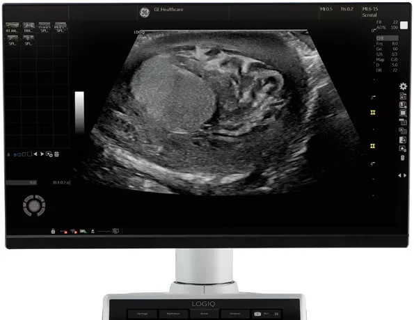 monitor