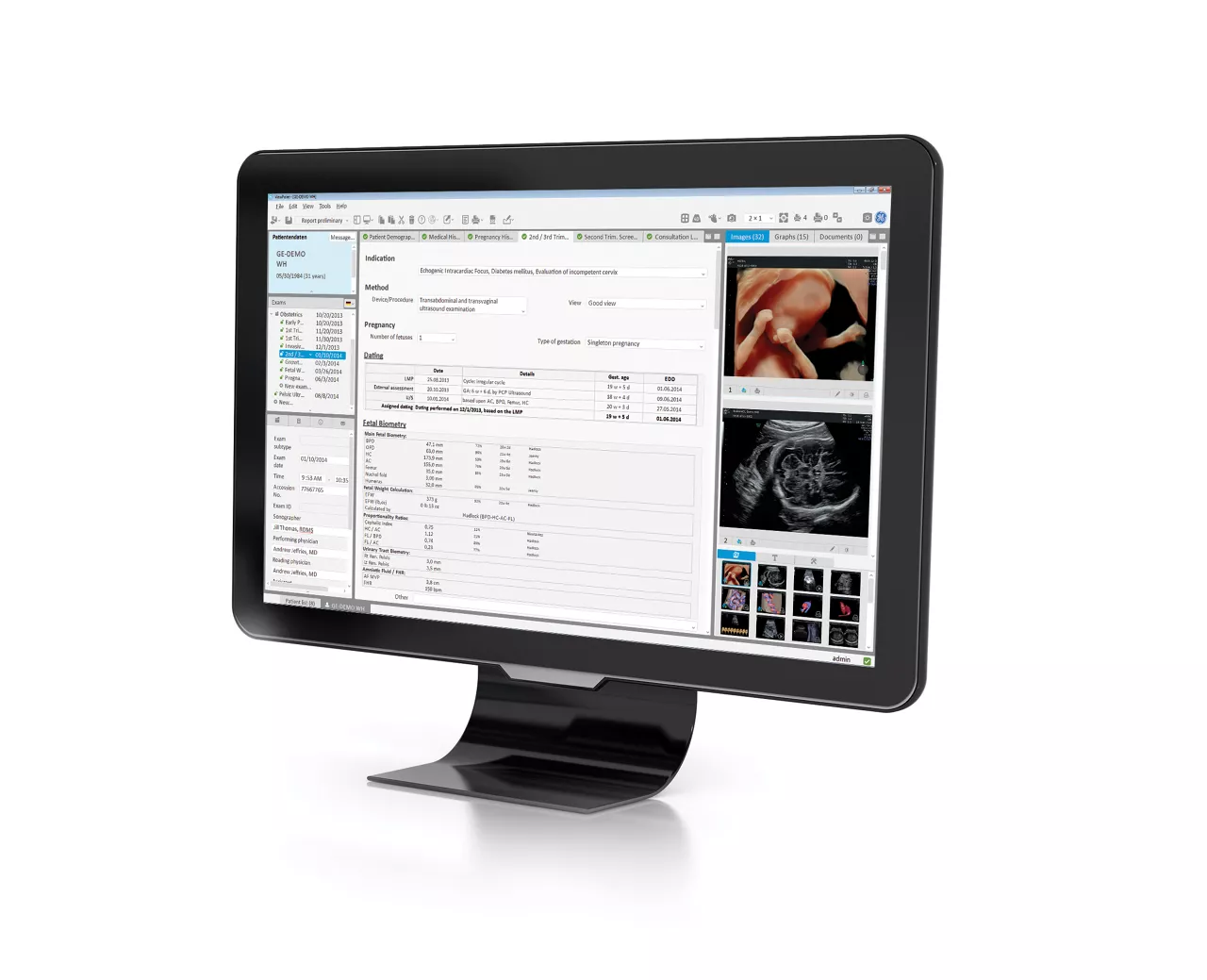 monitor left