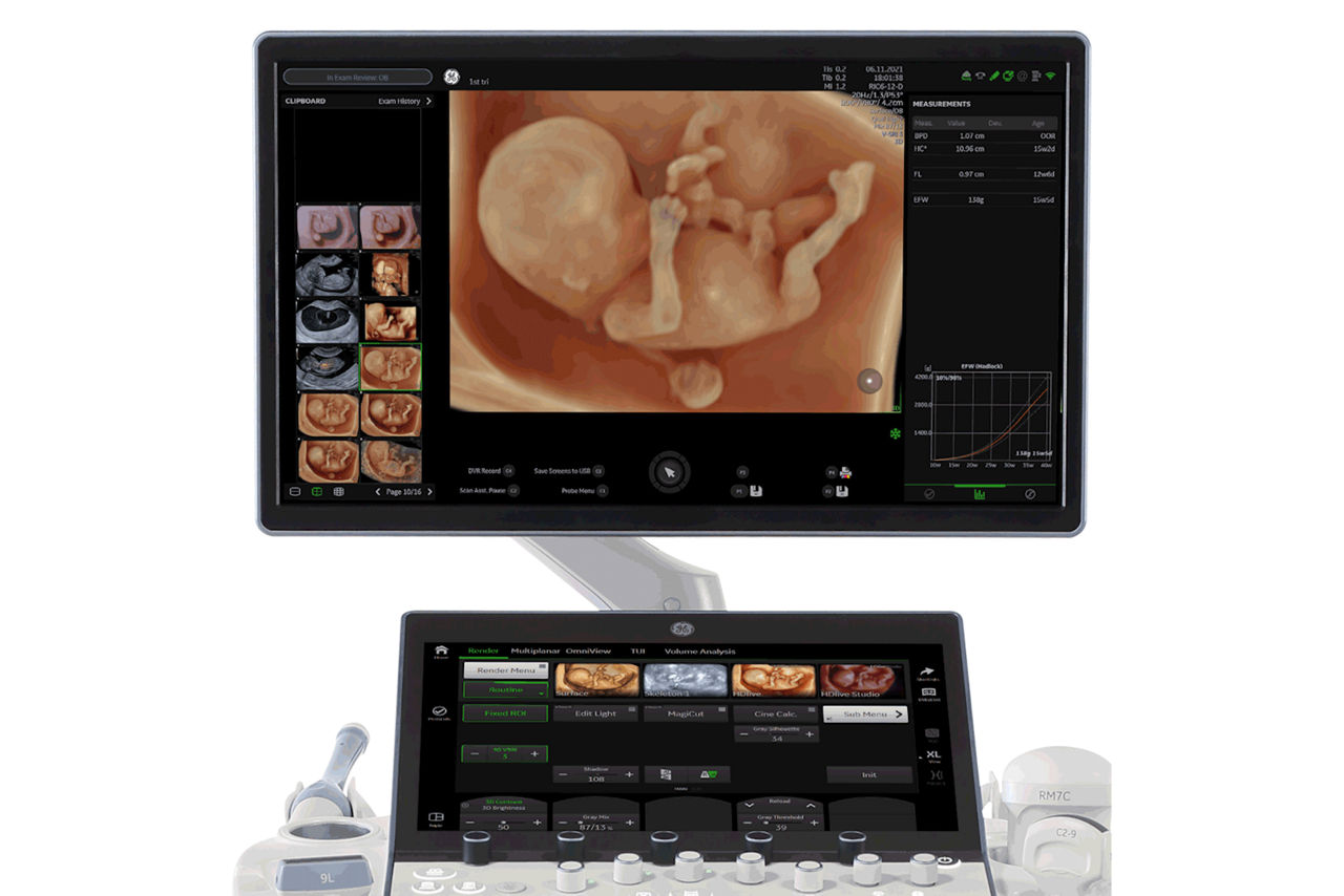 Monitor-of-Voluson-Expert-22