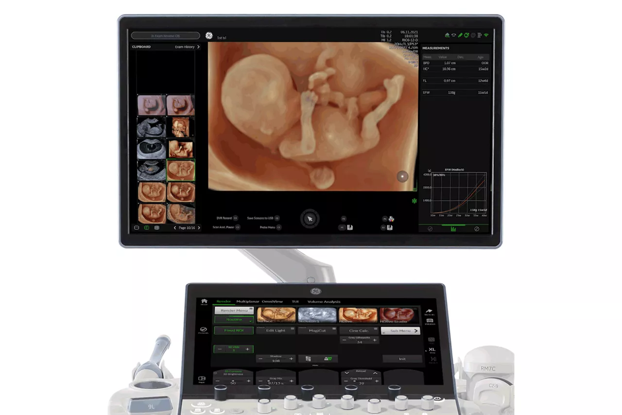 Monitor-of-Voluson-Expert-22