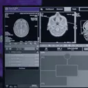 content card image