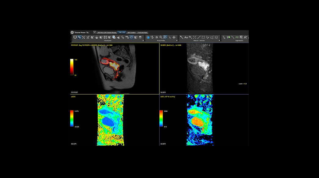 <p>MR Advanced Visualization</p>
