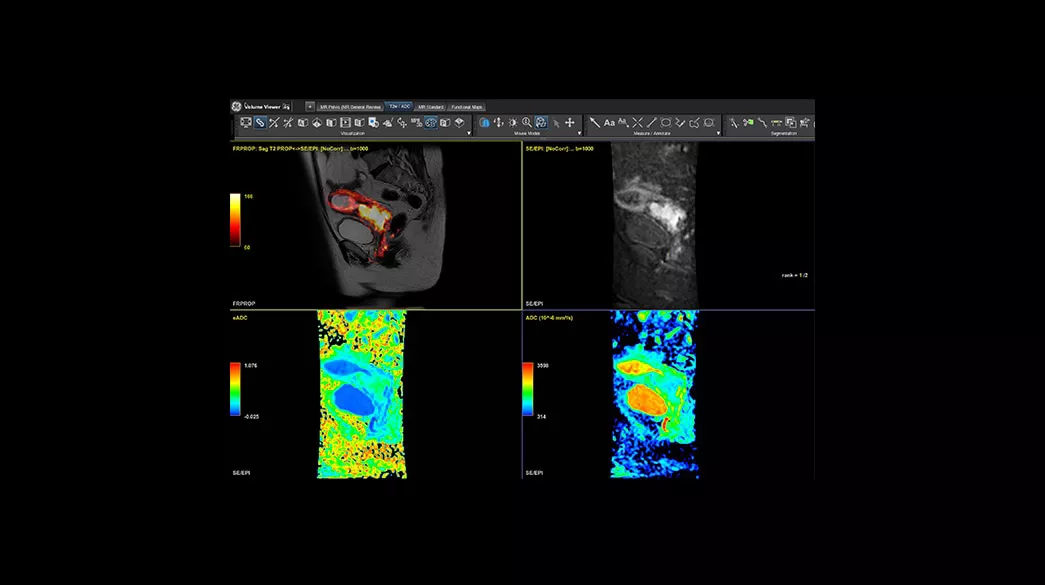 <p>MR Advanced Visualization</p>
