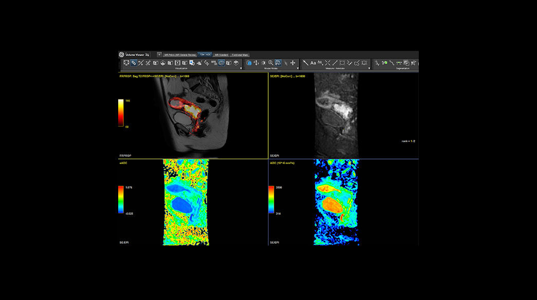 MR-Advanced-Visualization1040-x-585