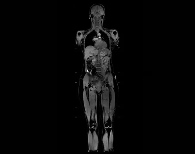 MR-Applications-body
