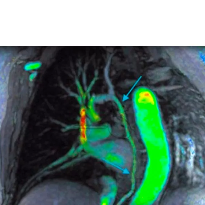 MR-Applications-cardiac