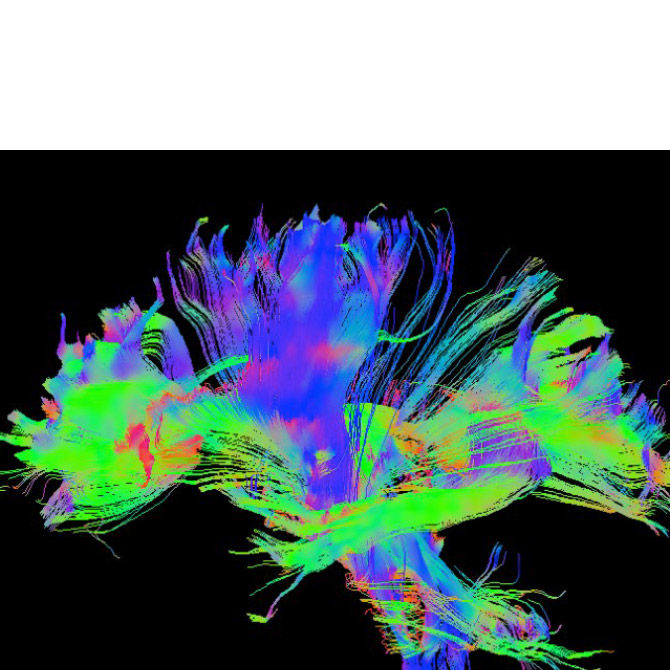 MR-Applications-neuro