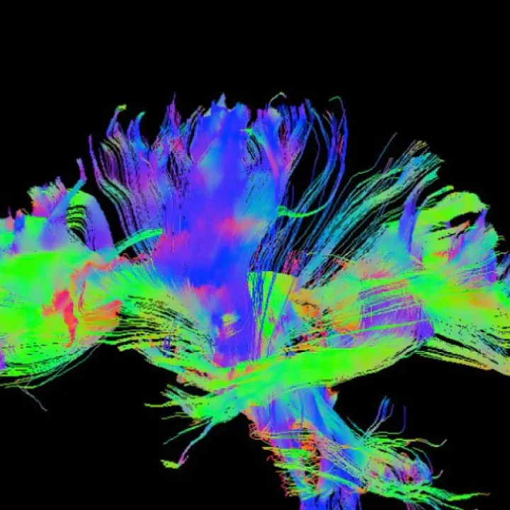 MR-Applications-neuro