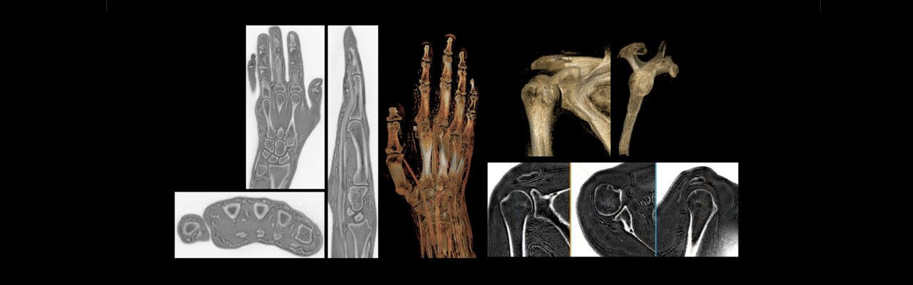 mr-bone-imaging-revolutionizing-mri-with-bone-ba-en