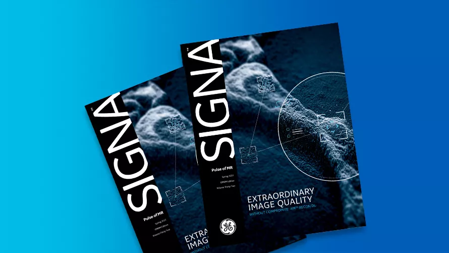 SIGNA Pulse of MR