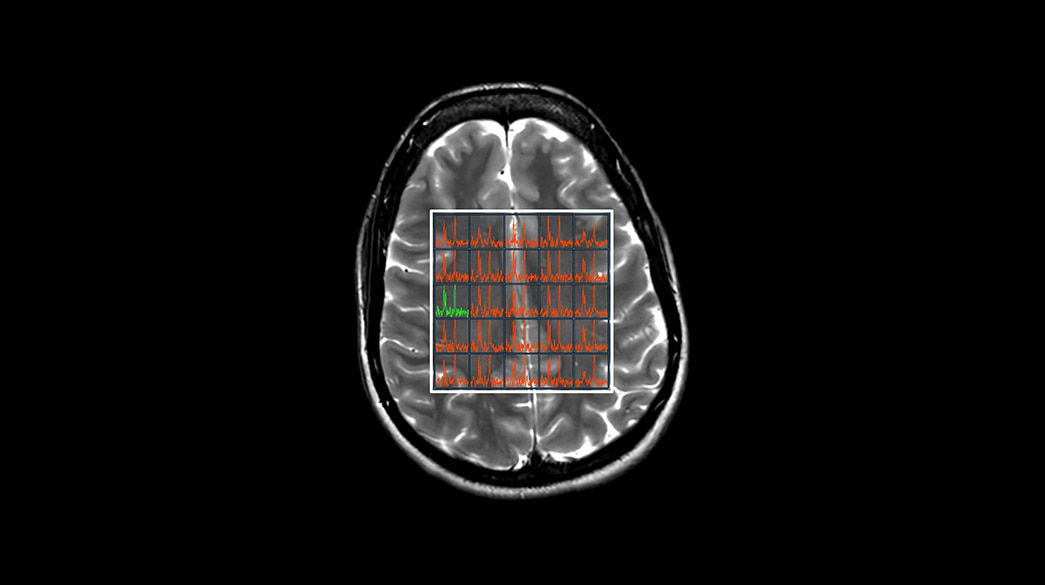 <p>MR Spectroscopy</p>
