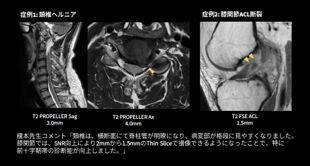 MRI AIRTM