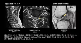 MRI AIRTM