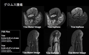 MRI Deep Learning