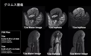 MRI Deep Learning
