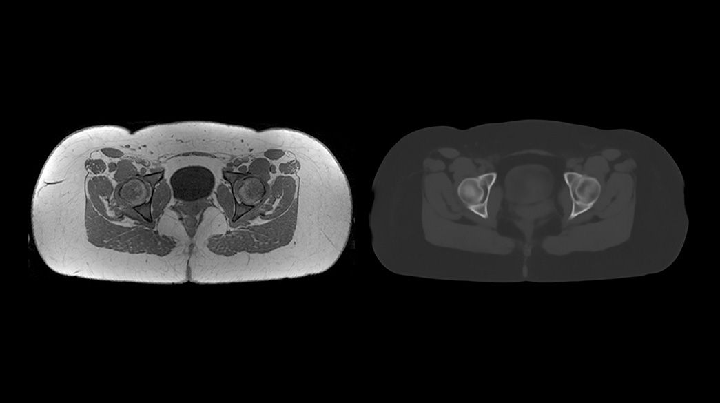 MRI-Planner1040-x-585