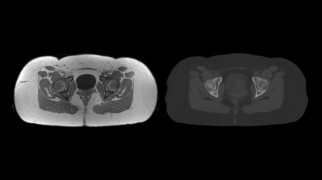 <p>MRI Planner – by Spectronic Medical</p>
