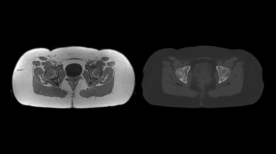 <p>MRI Planner – by Spectronic Medical</p>
