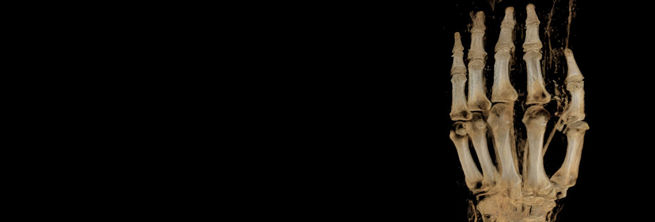 msk-mri-for-signa-HeaderImage-ci-en