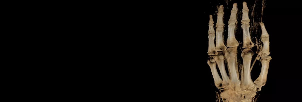 msk-mri-for-signa-HeaderImage-ci-en