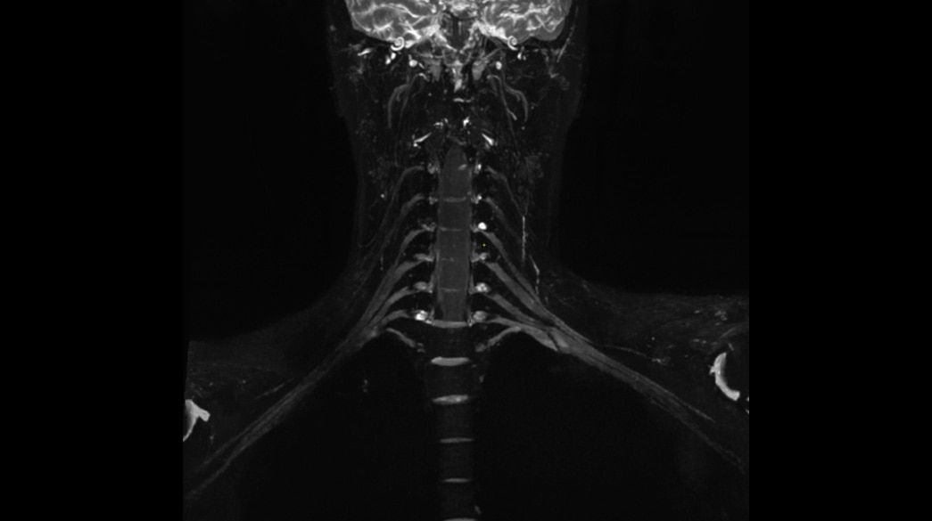 <p>CUBE STIR - compatible with AIR™ Recon DL</p>
