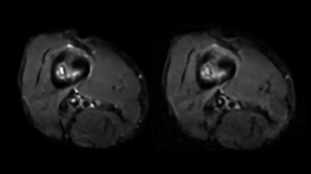 <p>Diffusion &amp; Diffusion Tensor Imaging – Compatible with AIR Recon DL</p>
