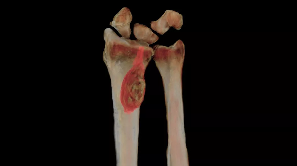 <p>oZTEo</p>
