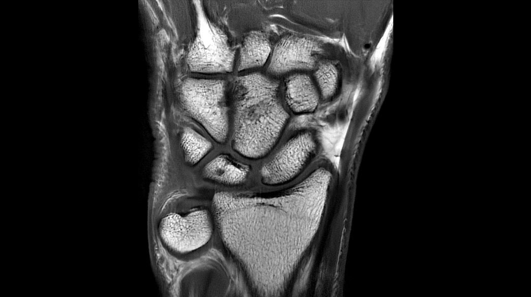 <p>PROPELLER - Compatible with AIR™ Recon DL</p>
