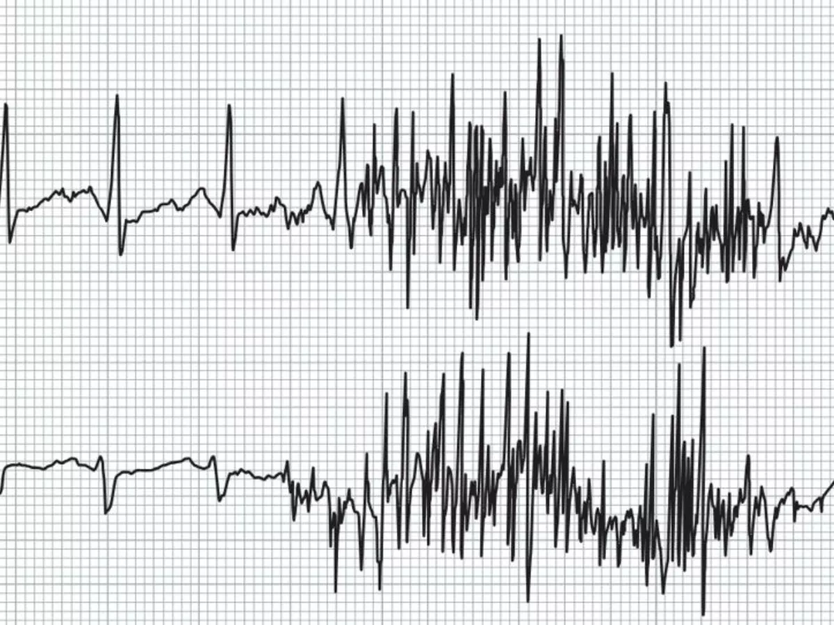 muscle-tremor