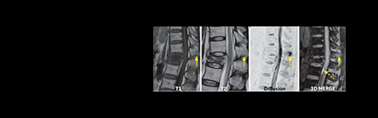 Musculoskeletal